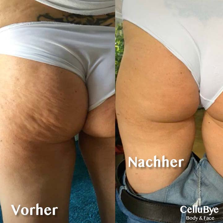 Produkt-CelluBye7